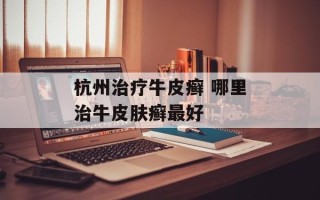 杭州治疗牛皮癣 哪里治牛皮肤癣最好