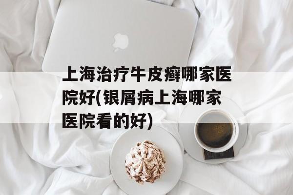 上海治疗牛皮癣哪家医院好(银屑病上海哪家医院看的好)-第1张图片-